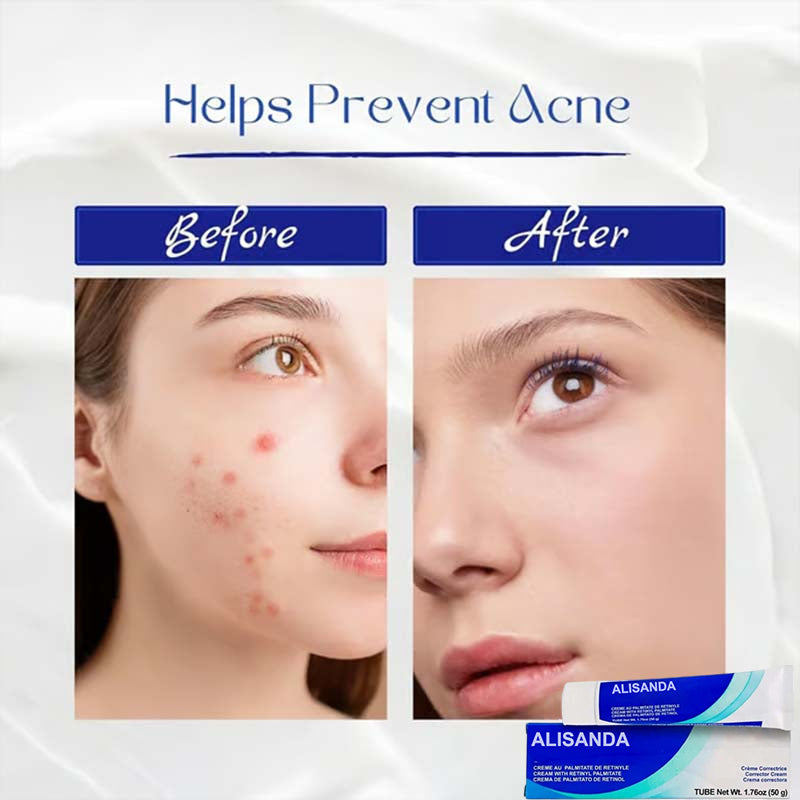 ✨Get clear, radiant skin quickly - Enjoy a 49% discount - ✨Ultimate skincare formula + hyaluronic acid - Suitable for all ages