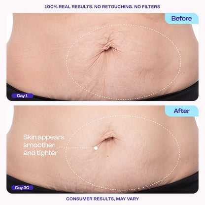 🌸Alisanda™ Firming Belly Cream - Body Firming Moisturizer for Visible Cellulite & Stretch Mark Reduction, 4.25oz